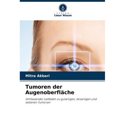 Tumoren der Augenoberfläche, Taschenbuch von Mitra Akbari, Verlag Unser Wissen, 978-620-7-82437-3