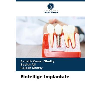 Einteilige Implantate, Taschenbuch von Sanath Kumar Shetty,Basith Ali,Rajesh Shetty, Verlag Unser Wissen, 978-620-3-89007-5