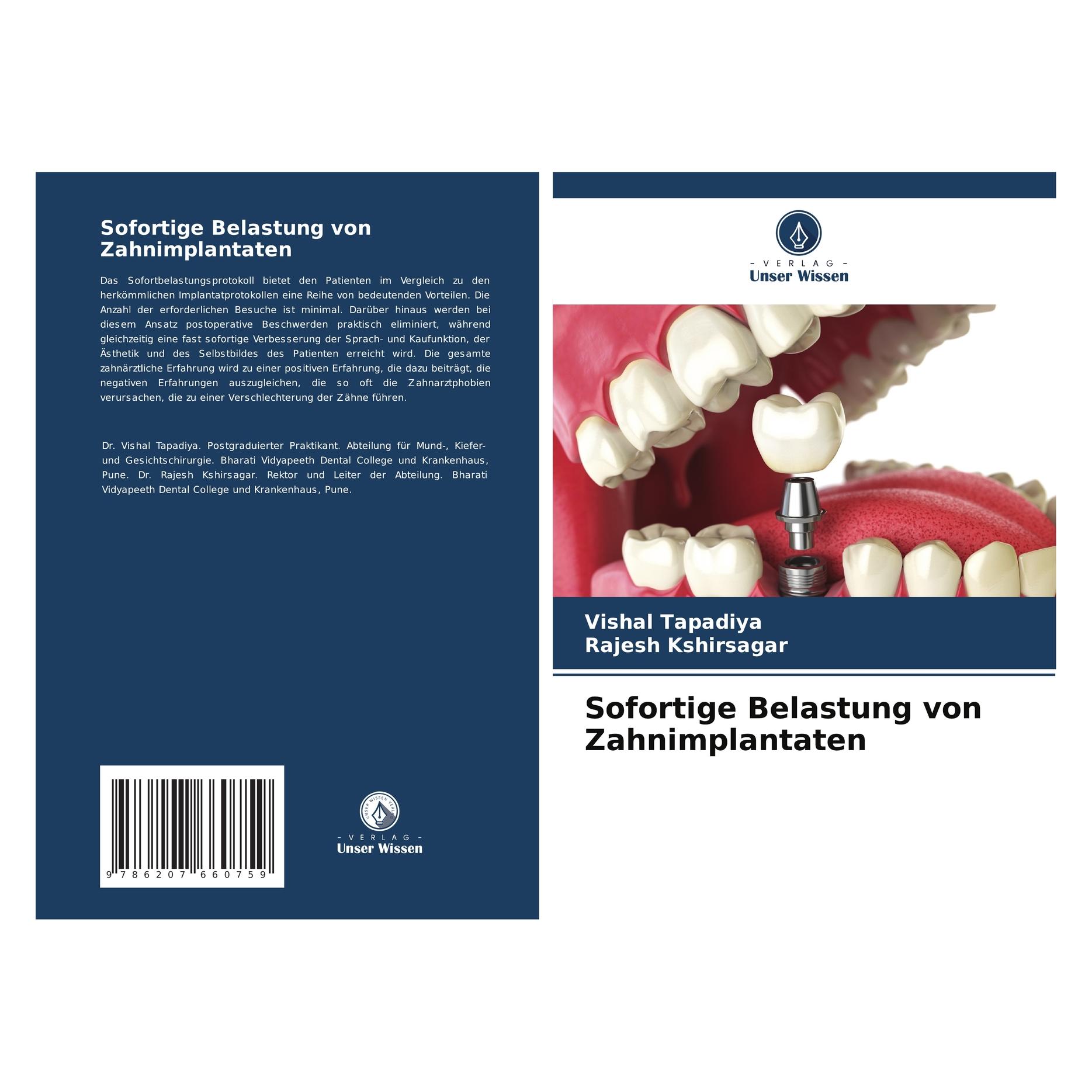 Unser Wissen Sofortige Belastung von Zahnimplantaten (57069464)