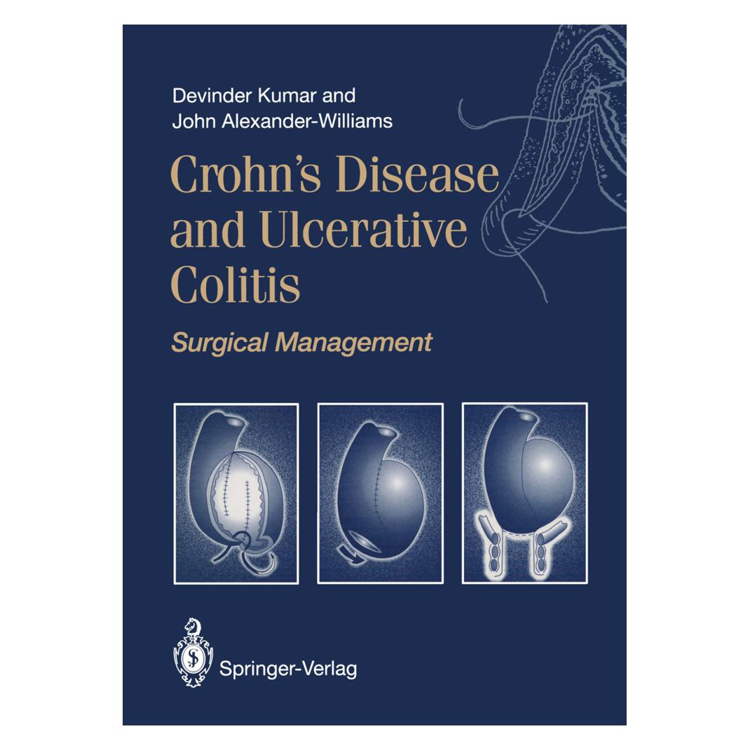 Springer Crohn's Disease and Ulcerative Colitis (Englisch, Softcover, Devinder Kumar, Devinder Kumar|John Alexander-Williams) (55533866)