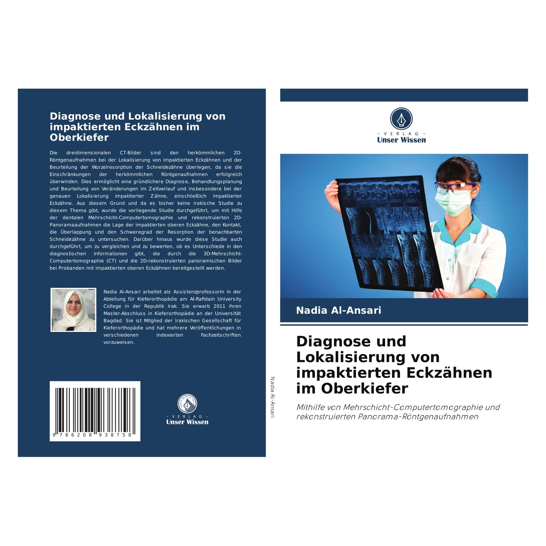 Umbreit Diagnose und Lokalisierung von impaktierten Eckzähnen im Oberkiefer (Deutsch, Softcover, Nadia Al-Ansari) (63622896)