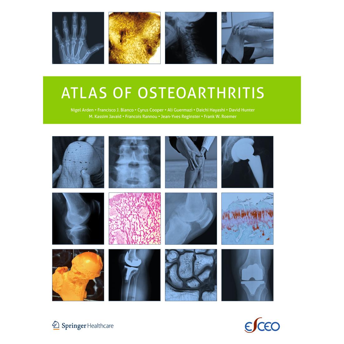 Springer Atlas of Osteoarthritis (Englisch, Softcover, C et al Cooper, C. Cooper, Francisco Blanco, Nigel Arden) (55571436)