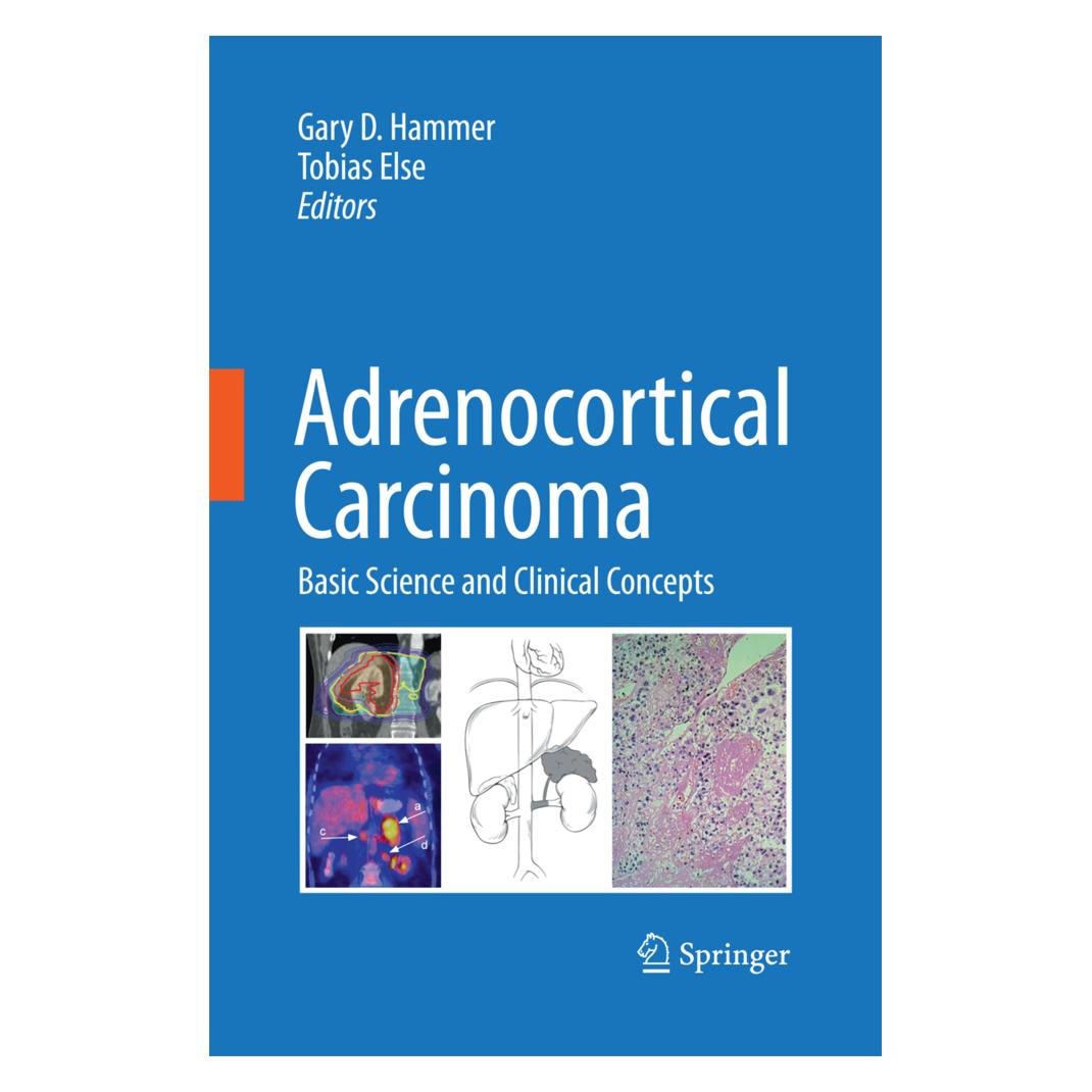 Springer Adrenocortical Carcinoma (Englisch, Softcover, Gary D. Hammer, Tobias Else) (55573663)