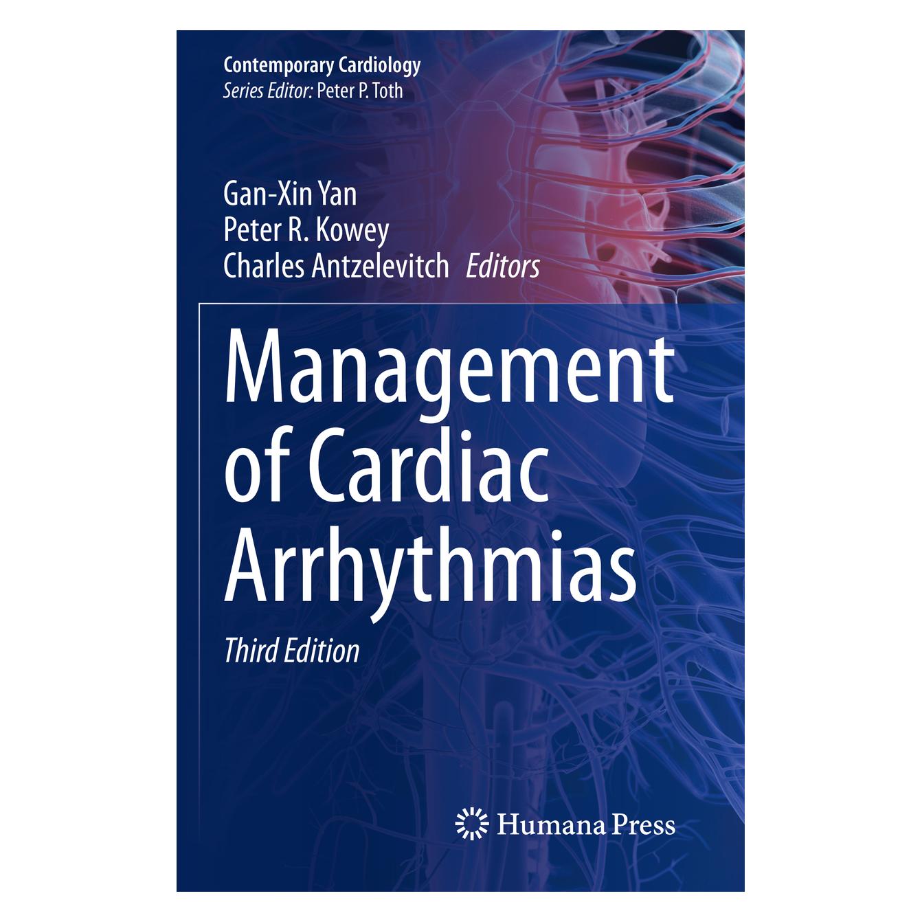 Springer Management of Cardiac Arrhythmias (Englisch, Softcover, Antzelevitch, Charles, Gan-Xin Yan, Peter, R Kowey) (56203415)