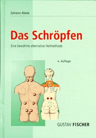 Johann Abele - Das Schröpfen - Eine bewährte alternative Heilmethode - Preis vom 09.10.2026 07:28:09 h