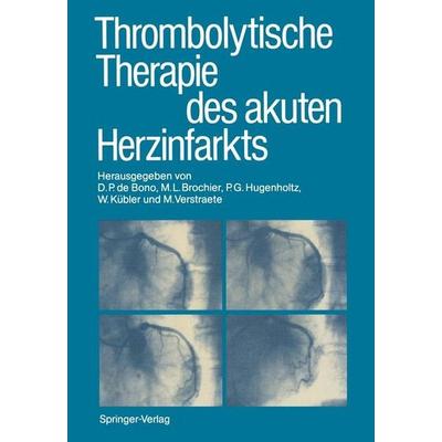 Thrombolytische Therapie des akuten Herzinfarkts, Taschenbuch von , Springer, 978-3-540-17922-1