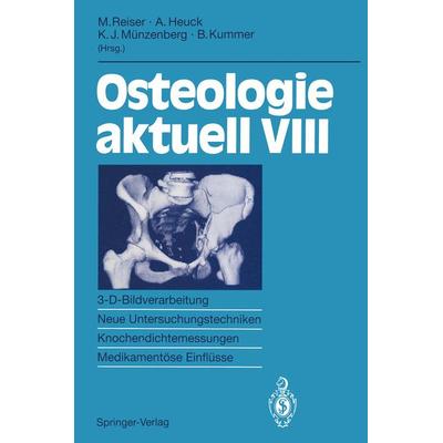 Osteologie aktuell VIII, Taschenbuch von , Springer Berlin, 978-3-540-57497-2