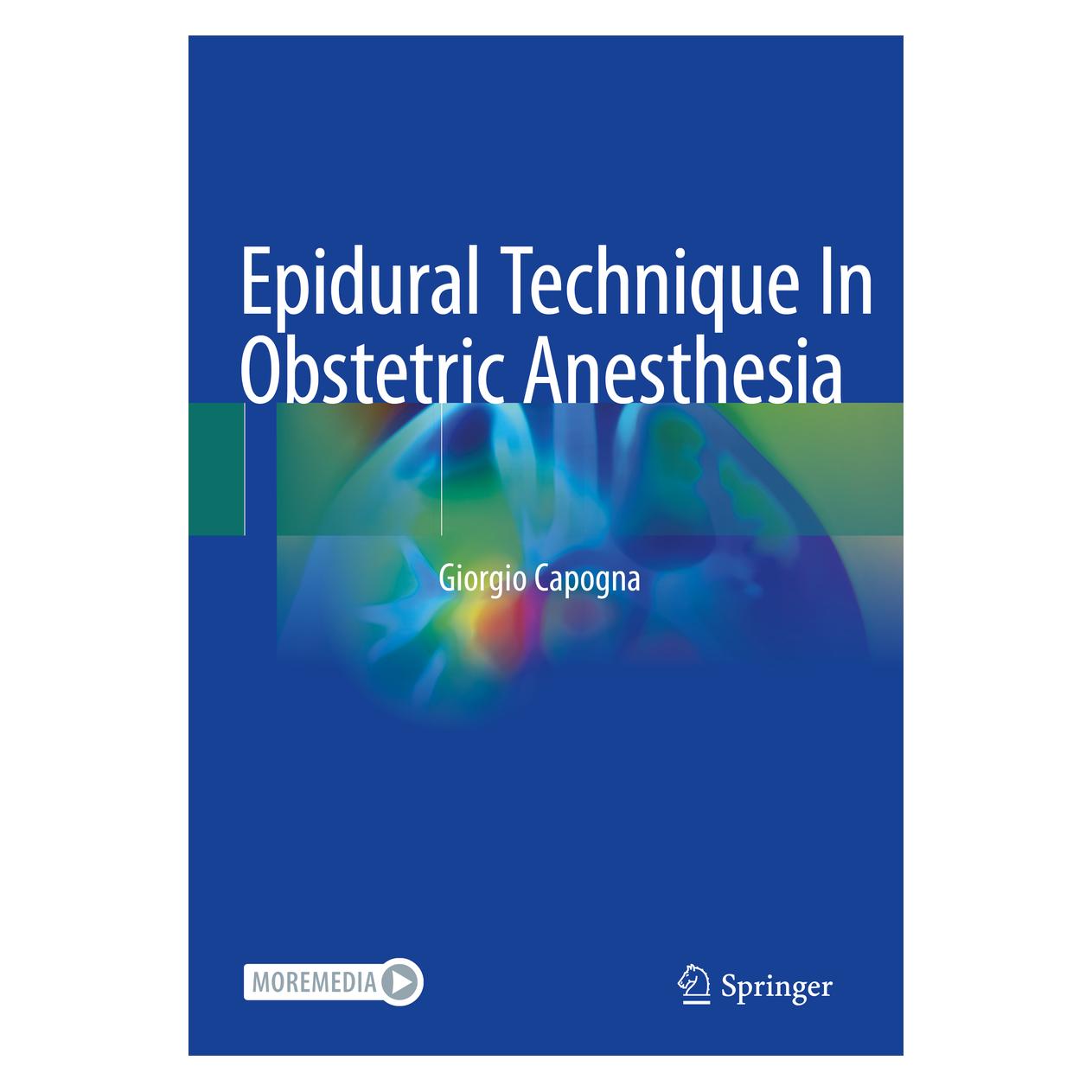 Springer Epidural Technique In Obstetric Anesthesia (Englisch, Softcover, Giorgio Capogna) (56194494)