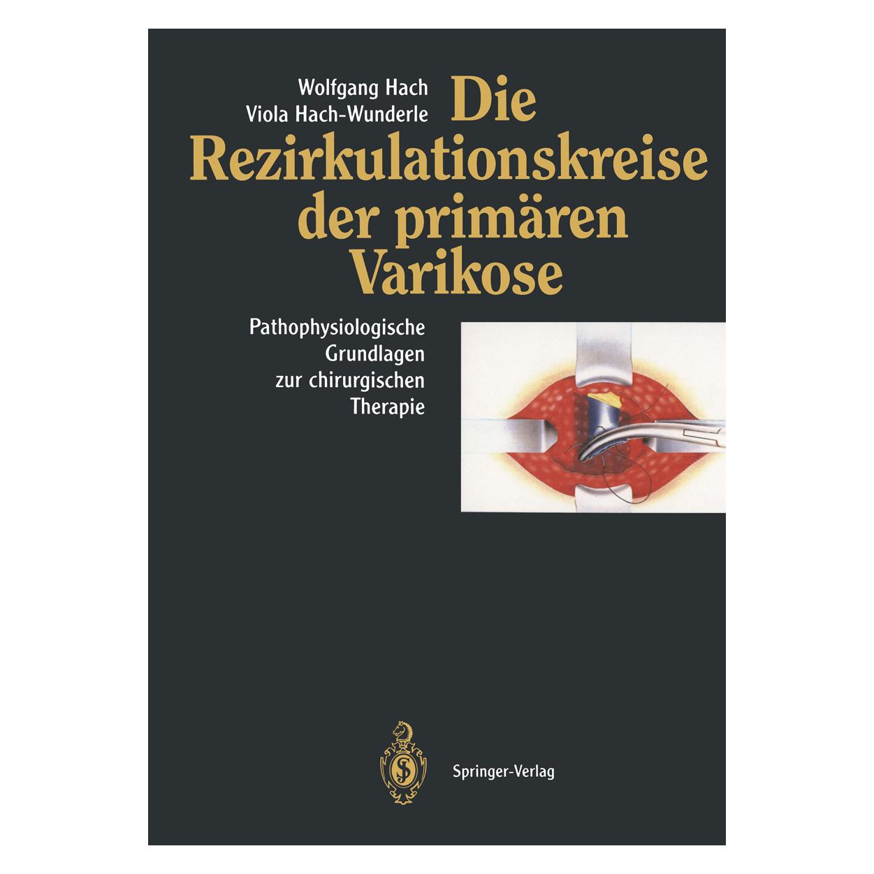 Springer Die Rezirkulationskreise der primären Varikose (Deutsch, Softcover, Viola Hach-Wunderle, Wolfgang Hach) (7337557)
