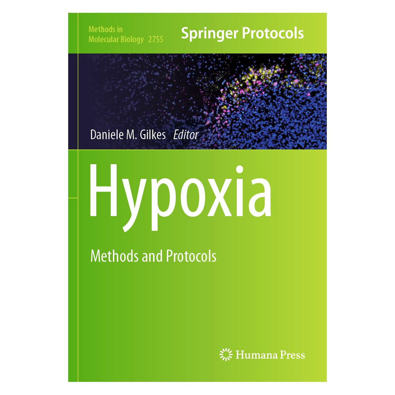 Springer Hypoxia (Englisch, Softcover) (64896421)