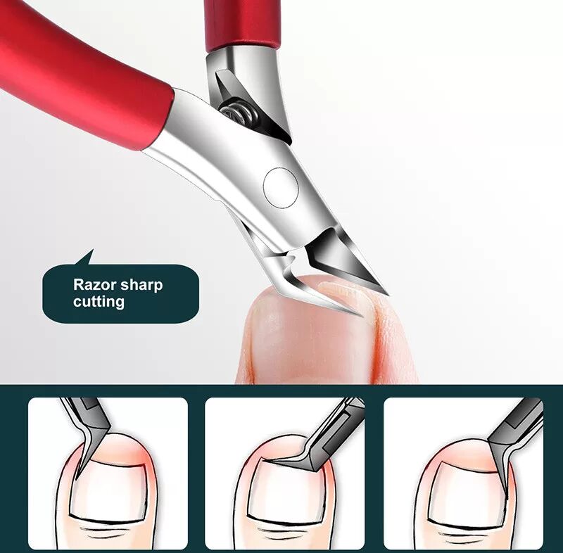 INF Coupe-ongles pour ongles incarnés