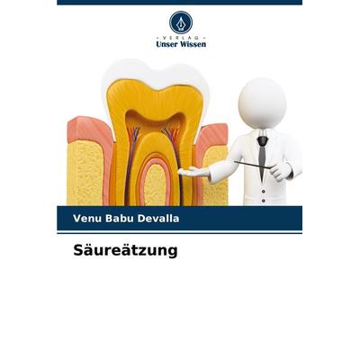 Säureätzung, Taschenbuch von Venu Babu Devalla, Verlag Unser Wissen, 978-620-8-04460-2