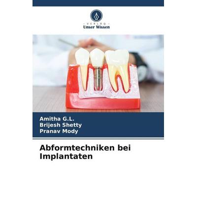 Abformtechniken bei Implantaten, Taschenbuch von Amitha G. L.,Brijesh Shetty,Pranav Mody, Verlag Unser Wissen, 978-620-6-30009-0