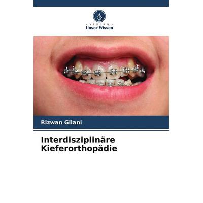 Interdisziplinäre Kieferorthopädie, Taschenbuch von Rizwan Gilani, Verlag Unser Wissen, 978-620-5-48542-2