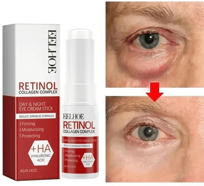 StayWell Korean Eye Cream For Dark Circles, Puffiness, Fine Lines & Under Eye Wrinkles Korean Eye Cream For Dark Circles, Puffiness, Fine Lines & Under Eye Wrinkles