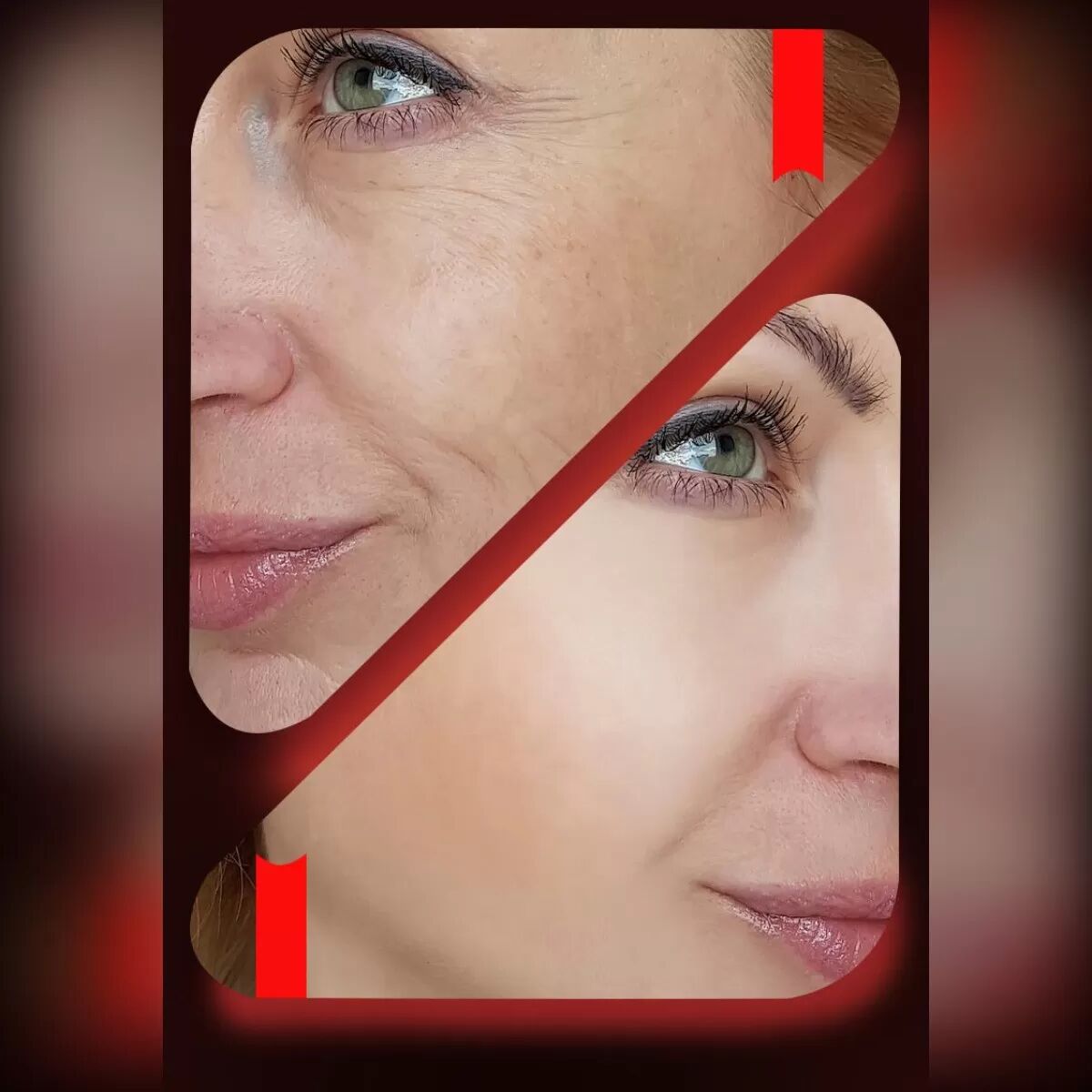 INF Masque Facial LED en Silicone 7 Couleurs - Thérapie de Soin Cutané Blanc