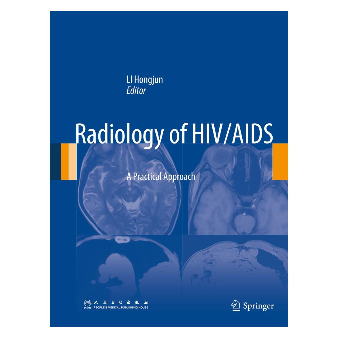 Springer Radiology of HIV/AIDS (Englisch, Hardcover, Hongjun Li) (9789400778221)