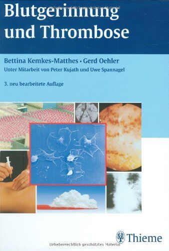 Bettina Kemkes-Matthes - Blutgerinnung und Thrombose - Preis vom 14.10.2026 23:07:16 h