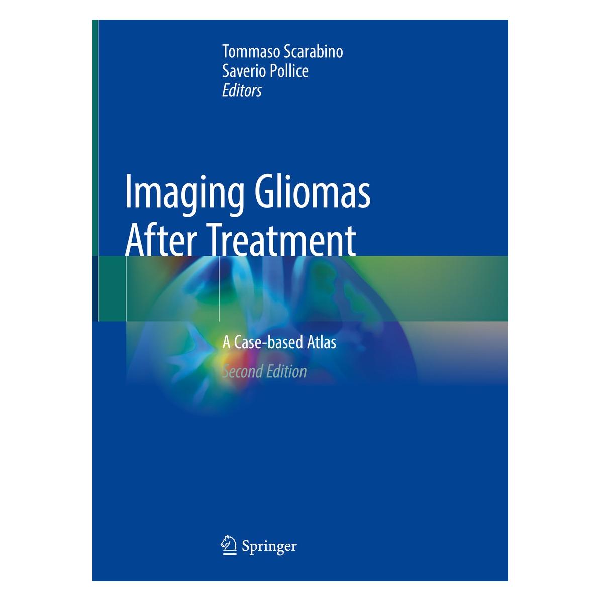 Springer Imaging Gliomas After Treatment (Englisch, Hardcover, Saverio Pollice, Tommaso Scarabino) (9783030312091)