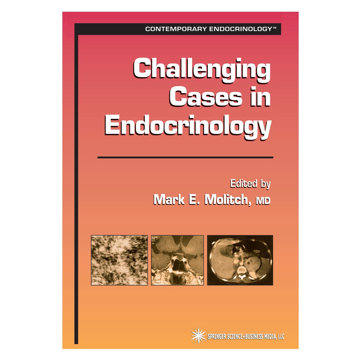 Springer Challenging Cases in Endocrinology (Englisch, Softcover, Mark E. Molitch) (55382545)