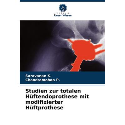 Studien zur totalen Hüftendoprothese mit modifizierter Hüftprothese, Taschenbuch von Saravanan K.,Chandramohan P., Verlag Unser Wissen,