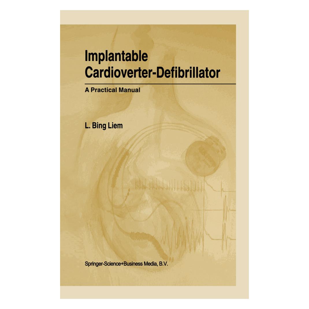 Springer Implantable Cardioverter-Defibrillator (Englisch, Softcover, L Bing Liem, L. Bing Liem) (55372904)