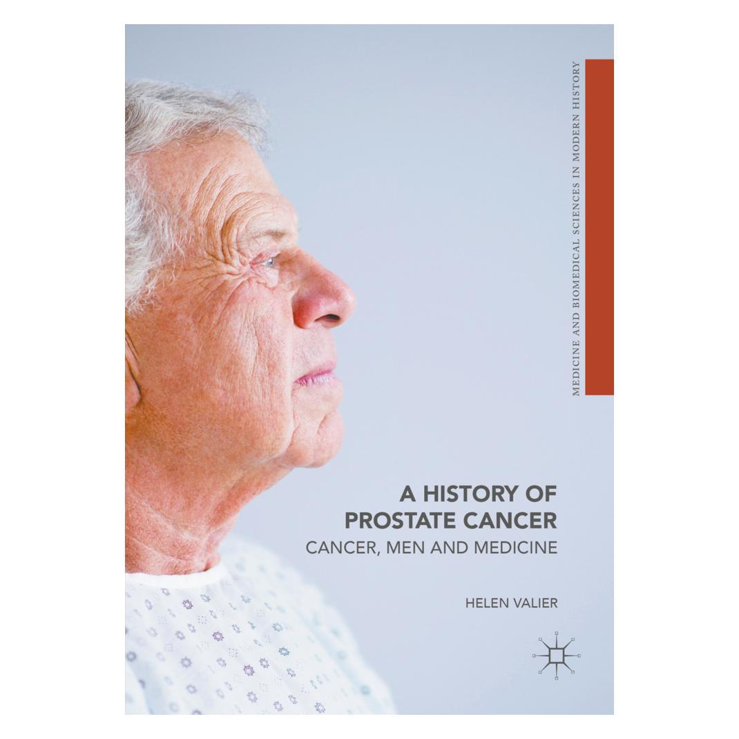 Springer A History of Prostate Cancer (Englisch, Softcover, Helen Valier) (56042526)
