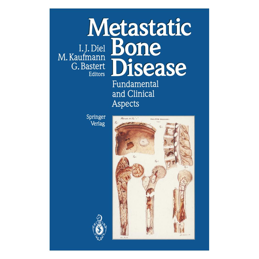 Springer Metastatic Bone Disease (Englisch, Softcover, Gunther B. Bastert, Ingo J. Diel, Manfred Kaufman) (55187793)