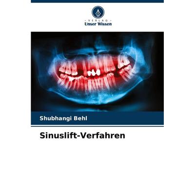 Sinuslift-Verfahren, Taschenbuch von Shubhangi Behl, Verlag Unser Wissen, 978-620-7-80030-8