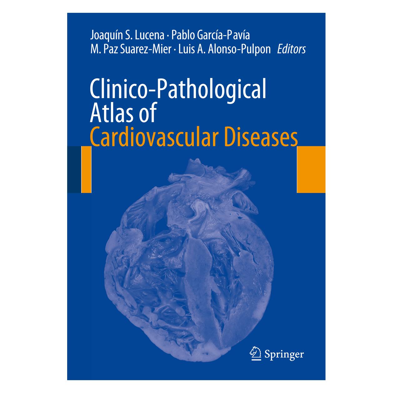 Springer Lucena:Clinico-Pathological Atlas of Ca (Englisch, Hardcover, Joaquín S. Lucena, Luis A. Alonso-Pulpon, M. Paz Suarez-Mier, Pablo García-Pavía) (9783319111452)