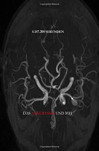 Anja Wendtland - 4.147.200 Sekunden - Das Aneurysma und ich - Preis vom 09.10.2026 07:28:09 h