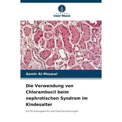 Die Verwendung von Chlorambucil beim nephrotischen Syndrom im Kindesalter, Taschenbuch von Aamir Al-Mosawi, Verlag Unser Wissen, 978-620-9-99499-9