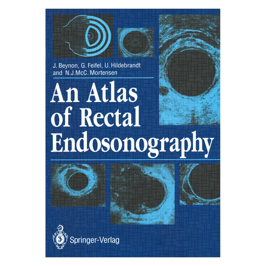 Springer An Atlas of Rectal Endosonography (Englisch, Softcover, Gernot Feifel, John Beynon, Ulrich et al Hildebrandt) (55532516)