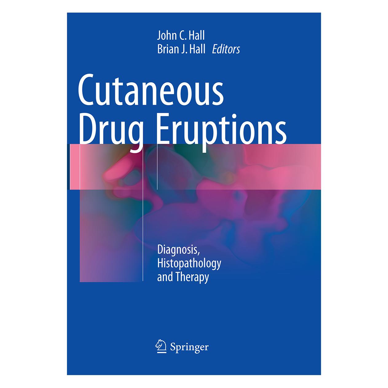 Springer Cutaneous Drug Eruptions (Englisch, Softcover, Brian J Hall, John C. Hall, John Hall) (55952861)