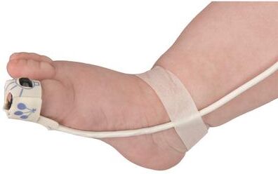 Nonin Medical """Flexi Wraps, Infant - bag of 25"""
