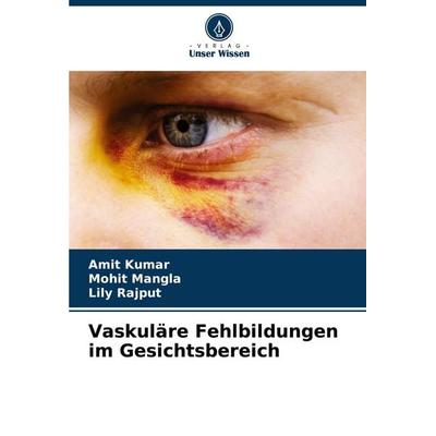 Vaskuläre Fehlbildungen im Gesichtsbereich, Taschenbuch von Amit Kumar,Mohit Mangla,Lily Rajput, Verlag Unser Wissen, 978-620-7-43450-3