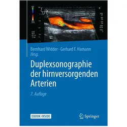 Duplexsonographie der hirnversorgenden Arterien, Fachbücher von Gerhard F. Hamann, Bernhard Widder, Gerhard Hamann, BernhardWidder