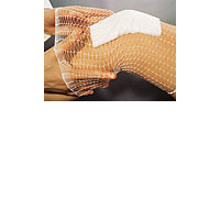 Lohmann & Rauscher GmbH & Co.KG TG fix Netzverband A 25 m weiß 1 St 00537332