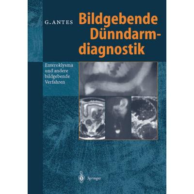Bildgebende Dünndarmdiagnostik, Taschenbuch von Günther Antes, Springer Berlin, 978-3-642-64346-0