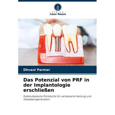 Das Potenzial von PRF in der Implantologie erschließen, Taschenbuch von Dhvani Parmar, Verlag Unser Wissen, 978-620-8-81715-2