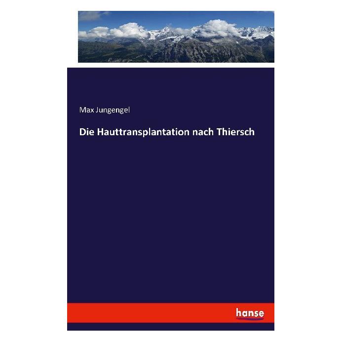 Hansebooks Die Hauttransplantation nach Thiersch (Deutsch, Softcover, Max Jungengel) (7448713)