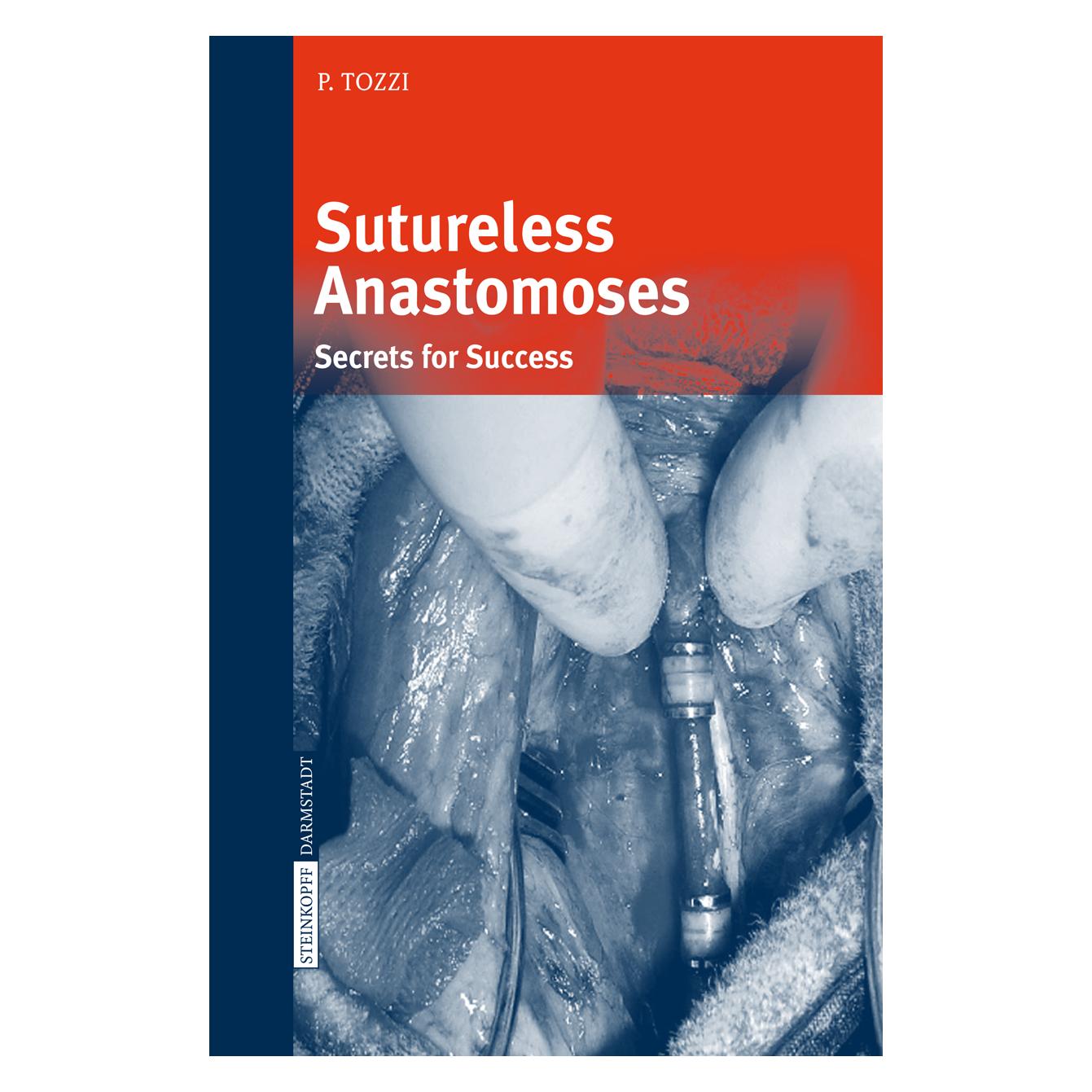 Dr. Dietrich Steinkopff Sutureless Anastomoses (Englisch, Softcover, Piergiorgio Tozzi) (55948938)