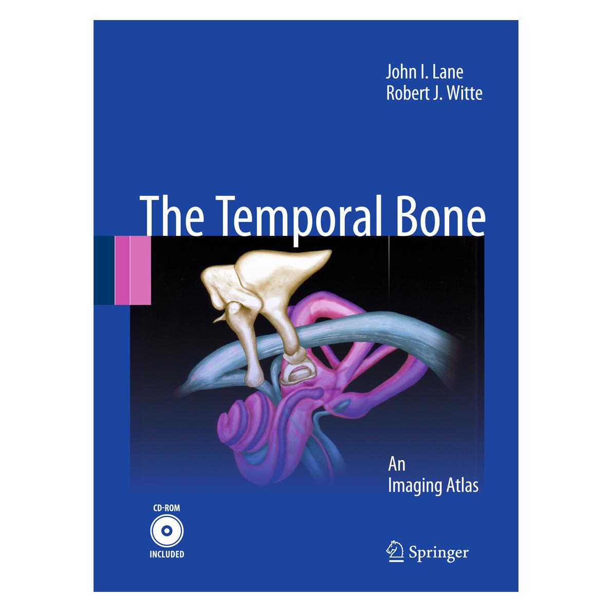 Springer Lane:Temporal Bone (Englisch, Hardcover, John I. Lane, Robert J. Witte) (9783642022098)