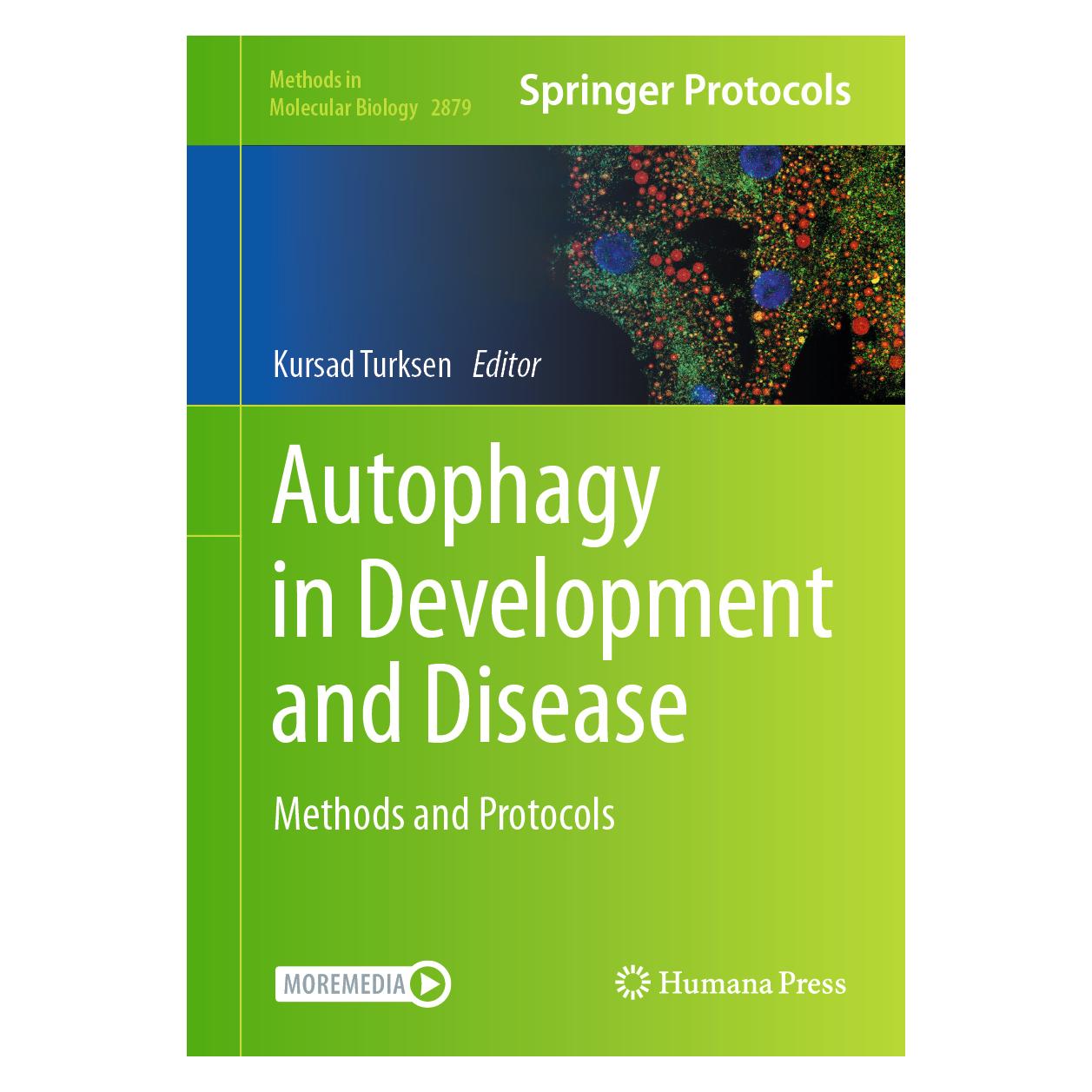 Springer Autophagy in Development and Disease (Englisch, Hardcover, Kursad Turksen) (63299816)