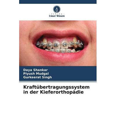 Kraftübertragungssystem in der Kieferorthopädie, Taschenbuch von Daya Shankar,Piyush Mudgal,Gurkeerat Singh, Verlag Unser Wissen, 978-620-9-65063-5