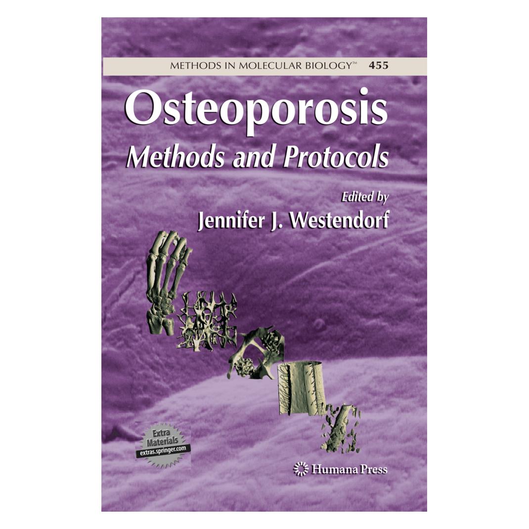 Springer Osteoporosis (Englisch, Softcover, Jennifer Westendorf) (55581009)