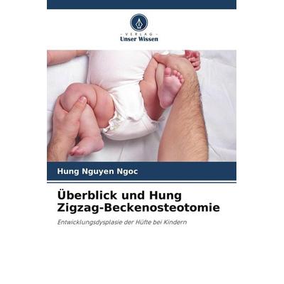 Überblick und Hung Zigzag-Beckenosteotomie, Taschenbuch von Hung Nguyen Ngoc, Verlag Unser Wissen, 978-620-5-35323-3