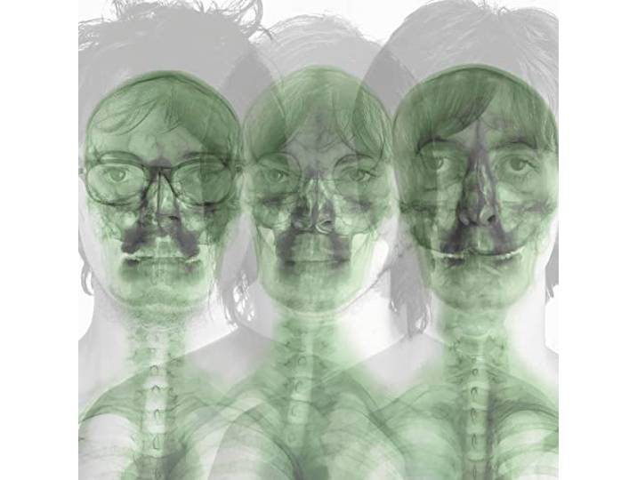 Supergrass