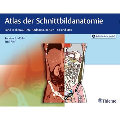 Atlas der Schnittbildanatomie, Set von Torsten Bert Möller,Emil Reif, Thieme, 978-3-13-203251-4