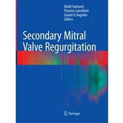 Secondary Mitral Valve Regurgitation, Fachbücher von Patrizio Lancellotti, Gianni D. Angelini, Khalil Fattouch